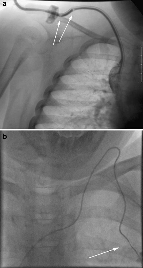 Fig. 17