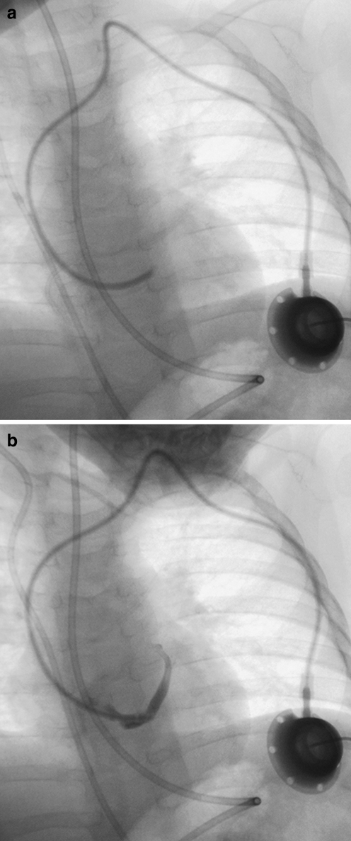 Fig. 6