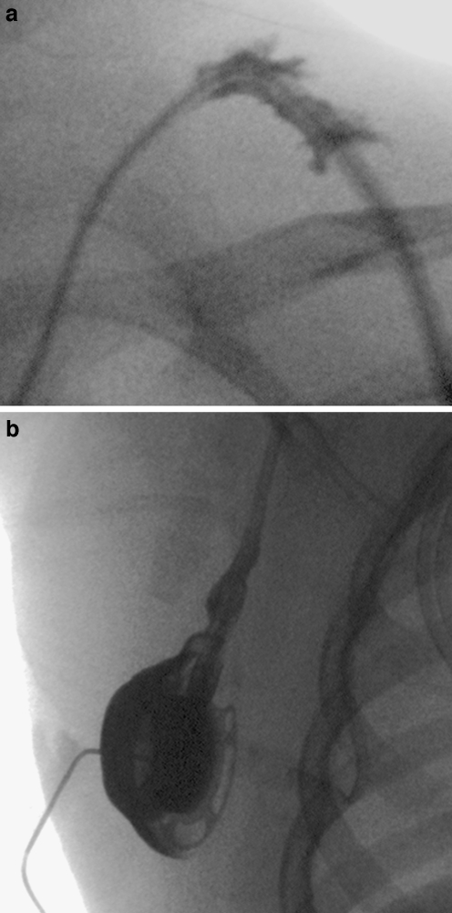 Fig. 18