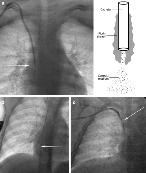 Fig. 22