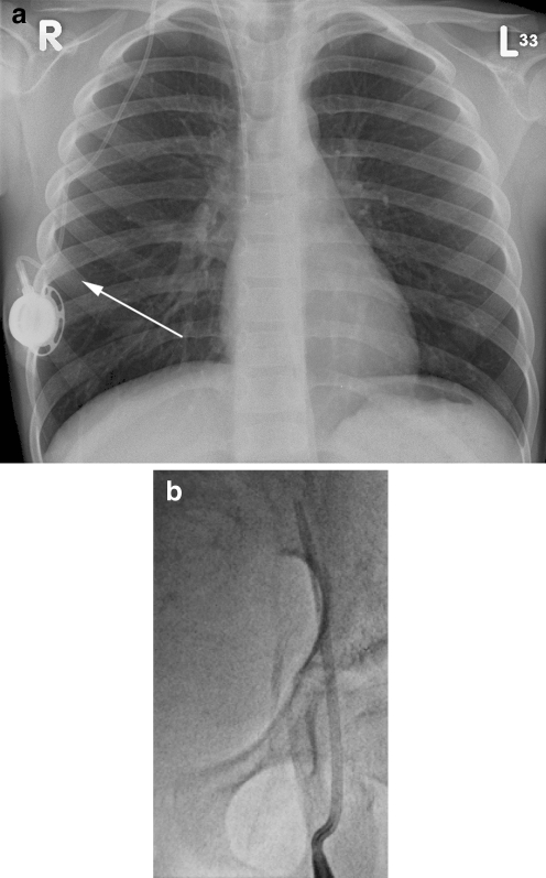 Fig. 8