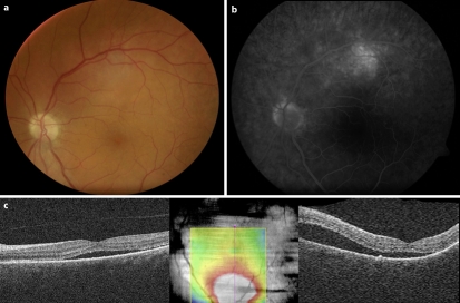 Fig. 1