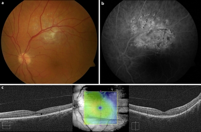 Fig. 3