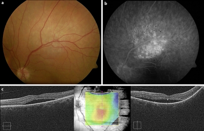 Fig. 2