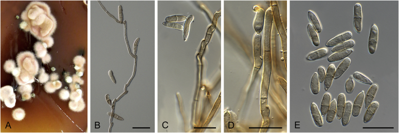 Fig. 21