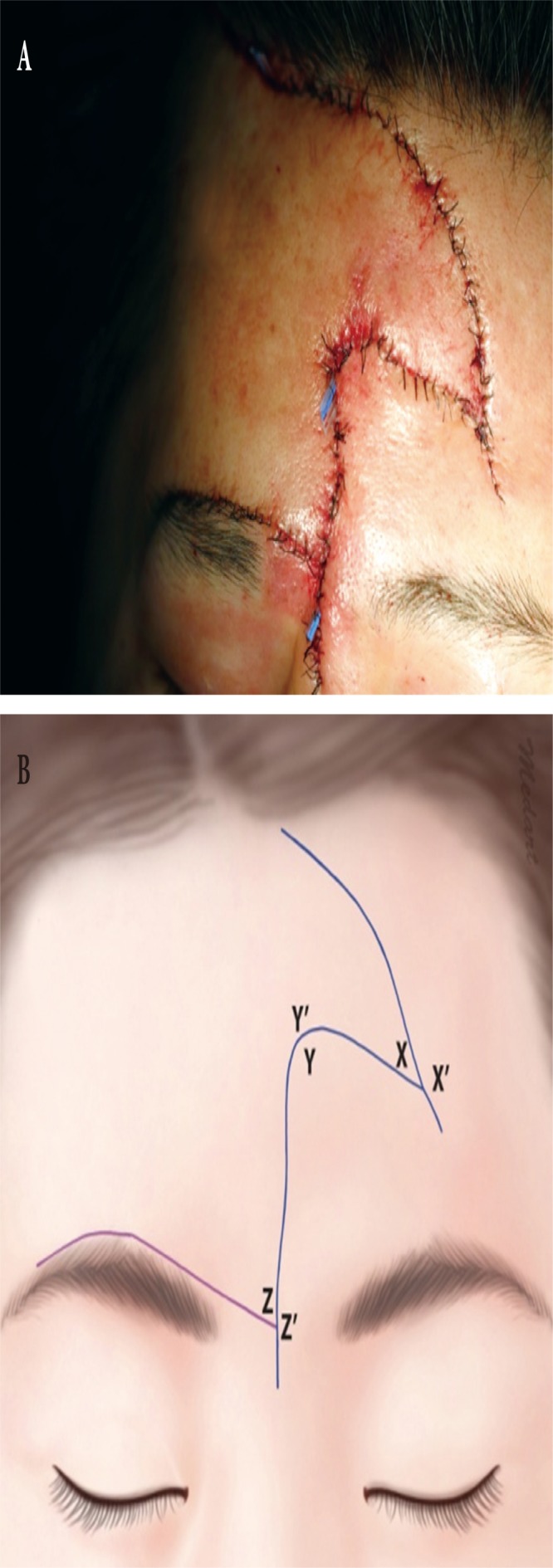Fig. 4.