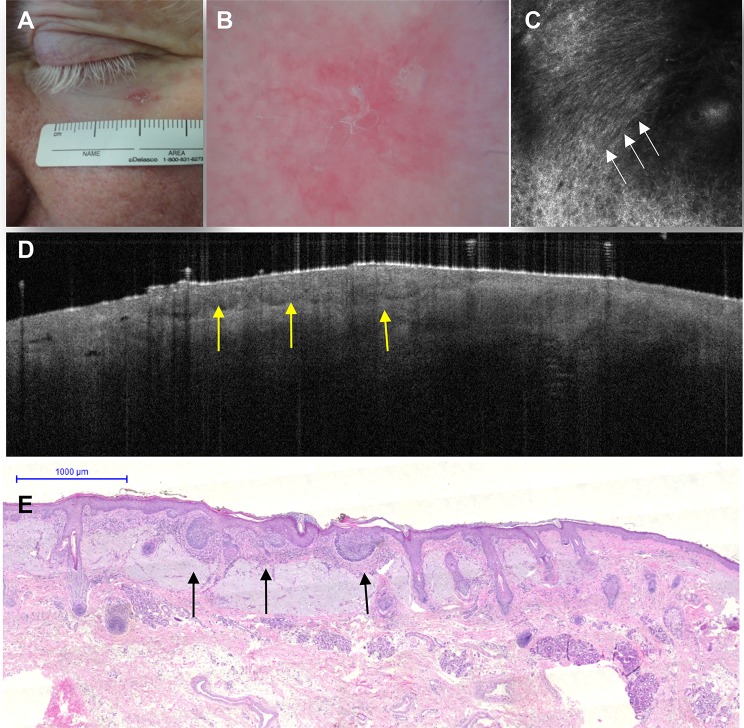 Fig. 6