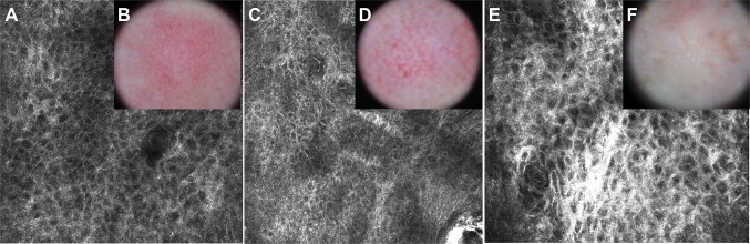 Fig. 7