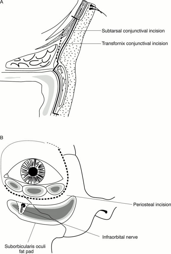 Figure 4  