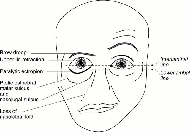 Figure 1  