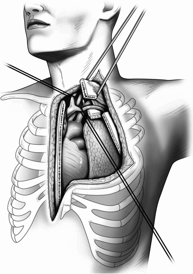 Fig.1