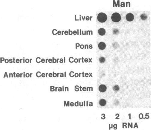 graphic file with name pnas00341-0218-d.jpg