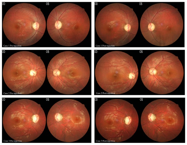 Fig. (1)