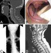 FIG. 1.
