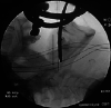 FIG. 2.