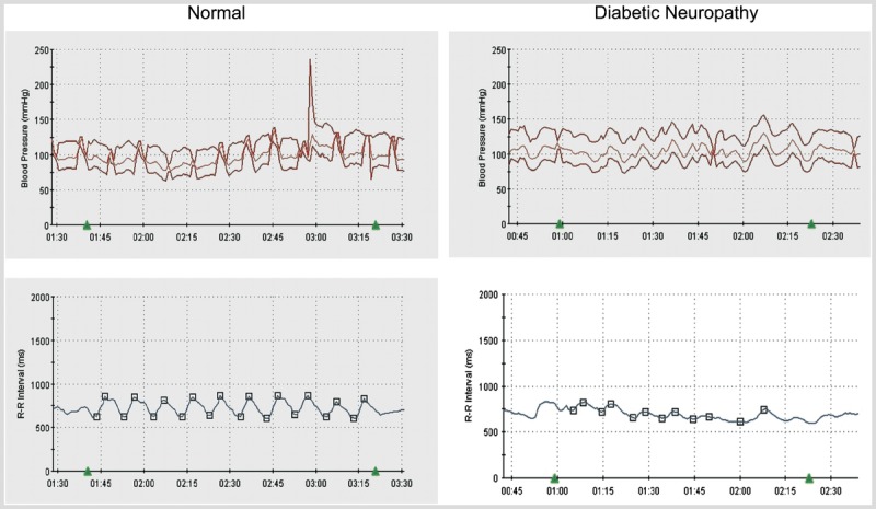 Figure 3-2