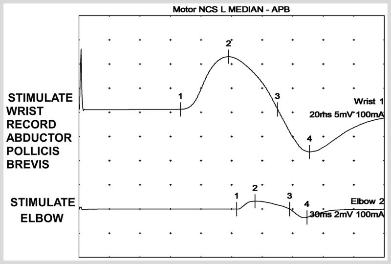 Figure 3-3