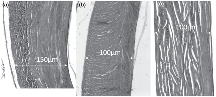 FIGURE 11