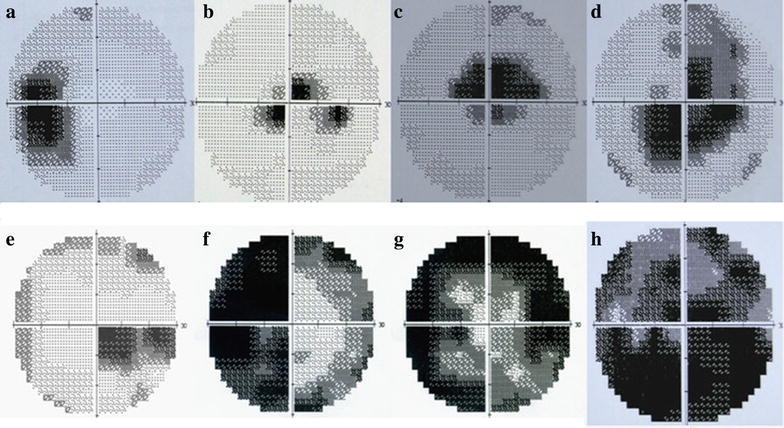 Fig. 2