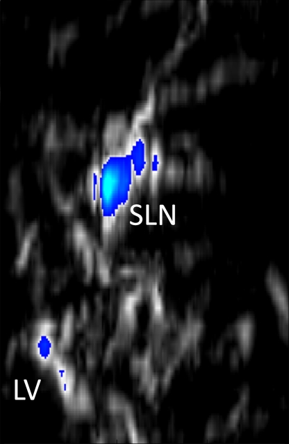 Figure 5d: