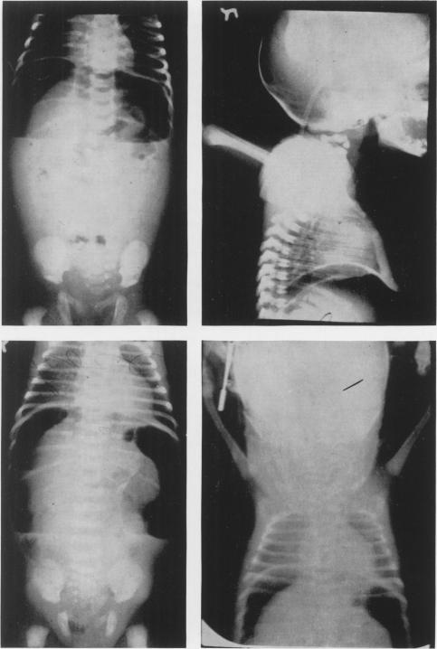 Fig. 1 to 4.