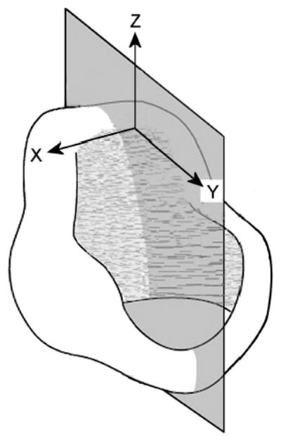 FIG. 1