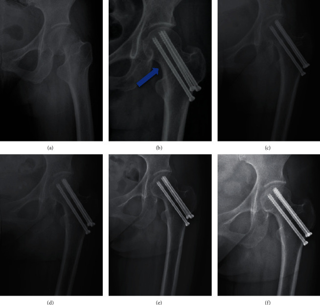 Figure 2