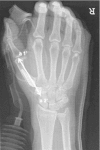 Fig. 4