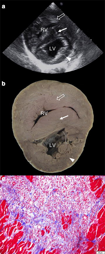 Fig. 3