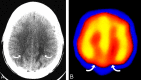 Fig 2.