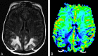Fig 3.