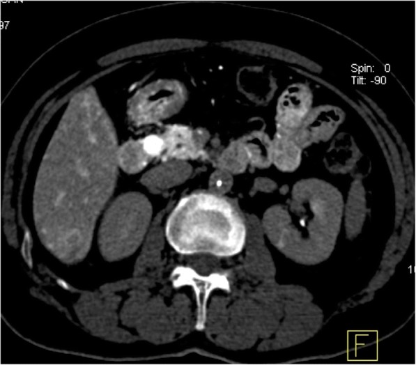 Fig. 1