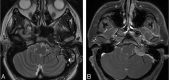 Fig 5.
