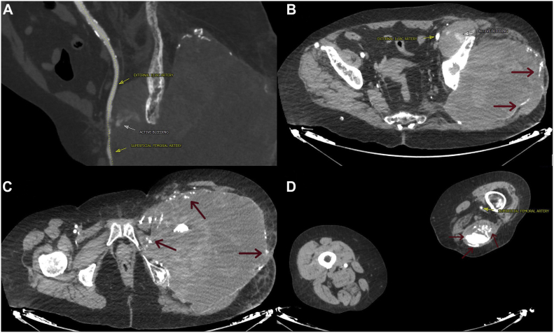 Fig 3