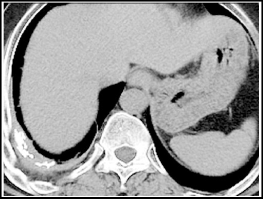 Fig.8