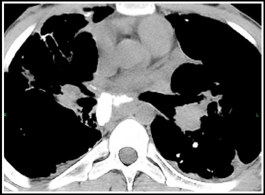 Fig.15