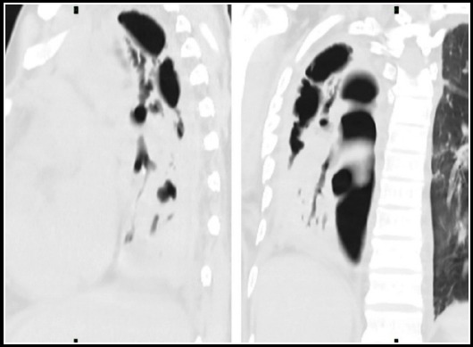 Fig.11