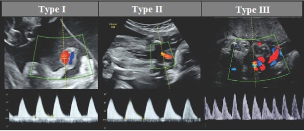 Figure S1