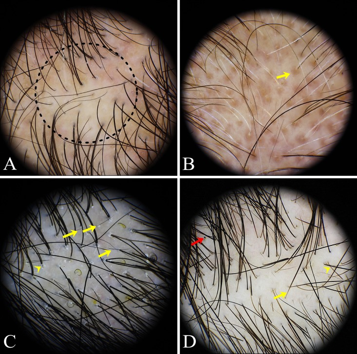 Fig. 3