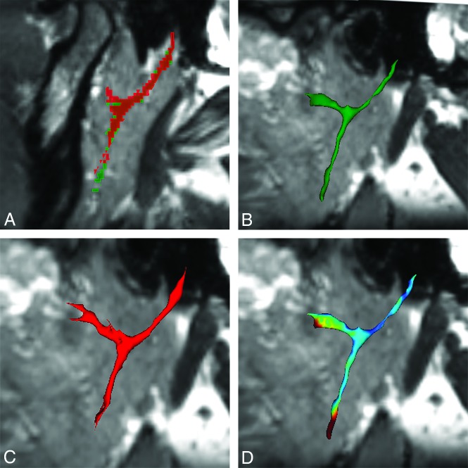 Fig 3.