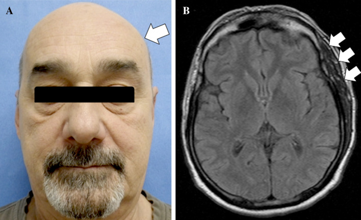 Fig. 1