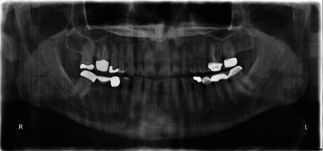 Fig. 2