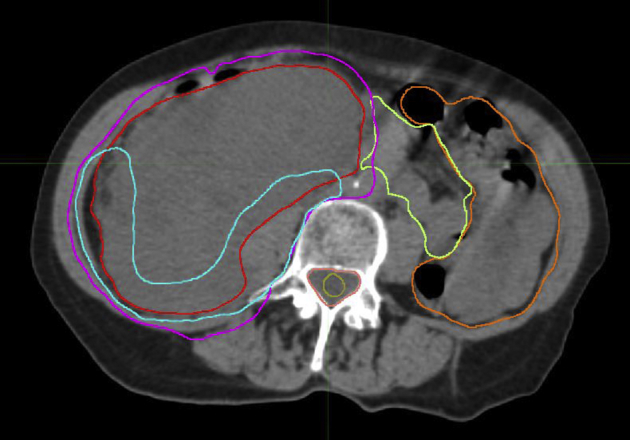 Figure 1