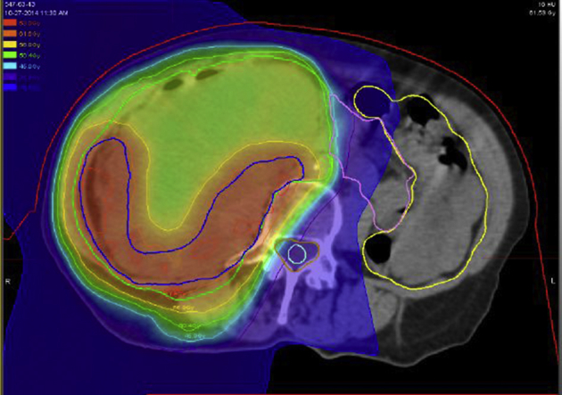 Figure 2