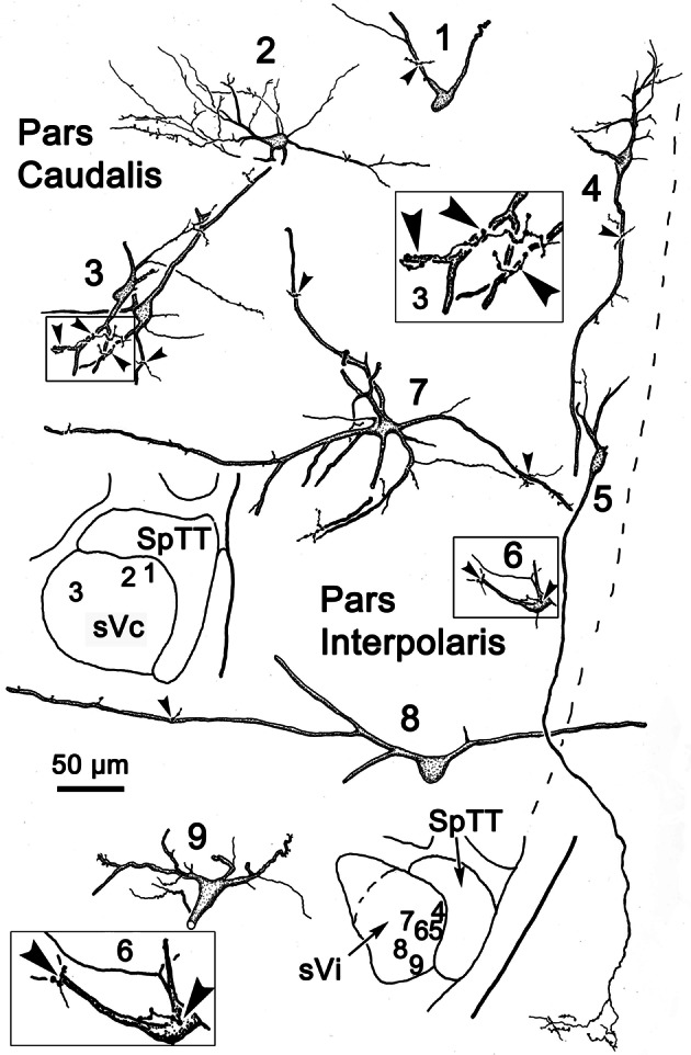 Figure 14