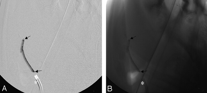 Fig 2.