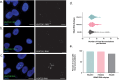 (a) Color image of U2OS cell nuclei with HSat2A1 RNA FISH signal in green (left). Grayscale signal shown to right. (b) Color image of U2OS cell nuclei with HSat2A2 RNA FISH signal in green (left). Grayscale signal shown to right. (c) Color image of U2OS cell nuclei with HSat2B RNA FISH signal in green (left). Grayscale signal shown to right. (d) Violin plot with ‘HSat2 RNA subtype’ on Y axis and ‘number of focal accumulations per nucleus’ on X axis. (e) Bar graph with ‘percent of nuclei with focal accumulations’ on Y axis and ‘HSat2RNA subtype’ on X axis.