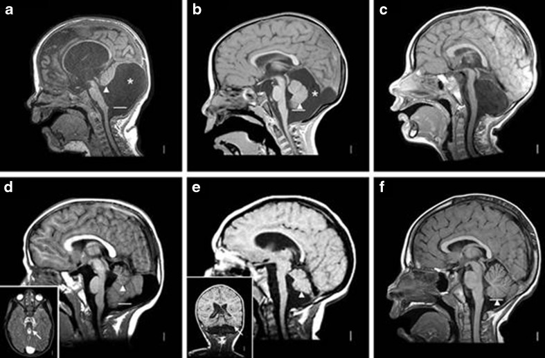 Fig. 14