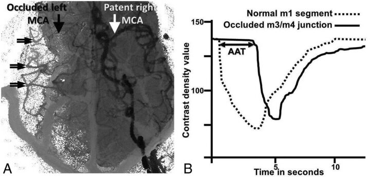 Fig 1.