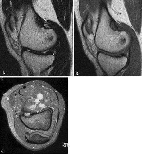 Fig. 3A–C